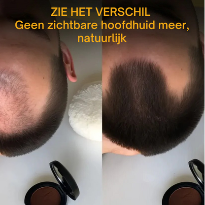 Veronni™ | Haarlijnvuller